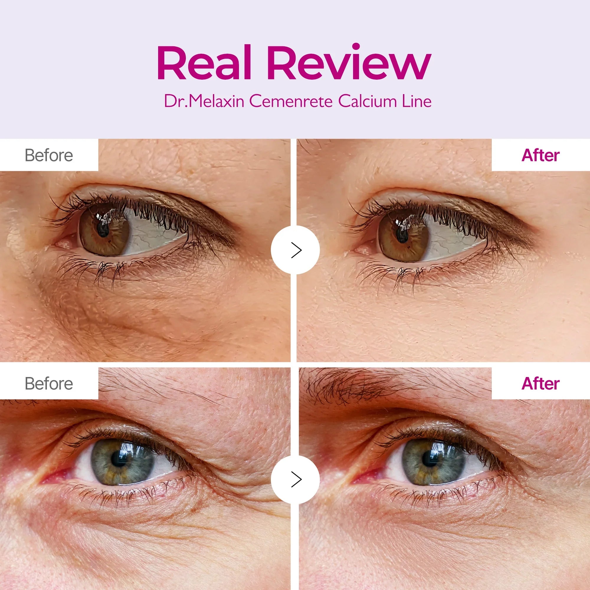Pack Melaxin Calcium Volume Multi Balm + Eye Patch